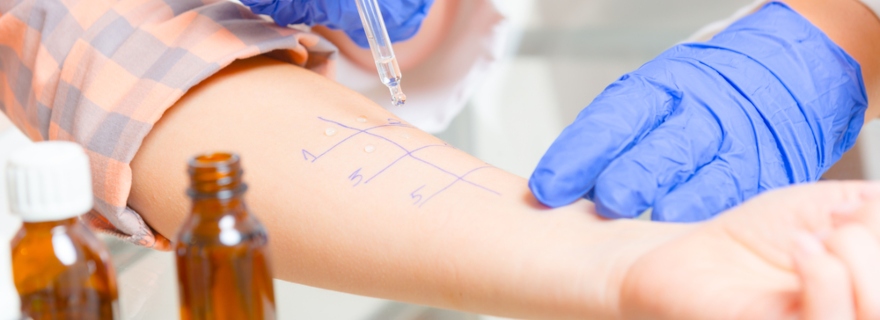 �Qu� tipo de alergias cubre el seguro de salud?