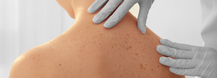 Examen dermatológico